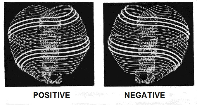 Positive and negative UPAs